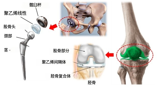 超高分子量聚乙烯在生物醫學應用中的性能與功能化綜述